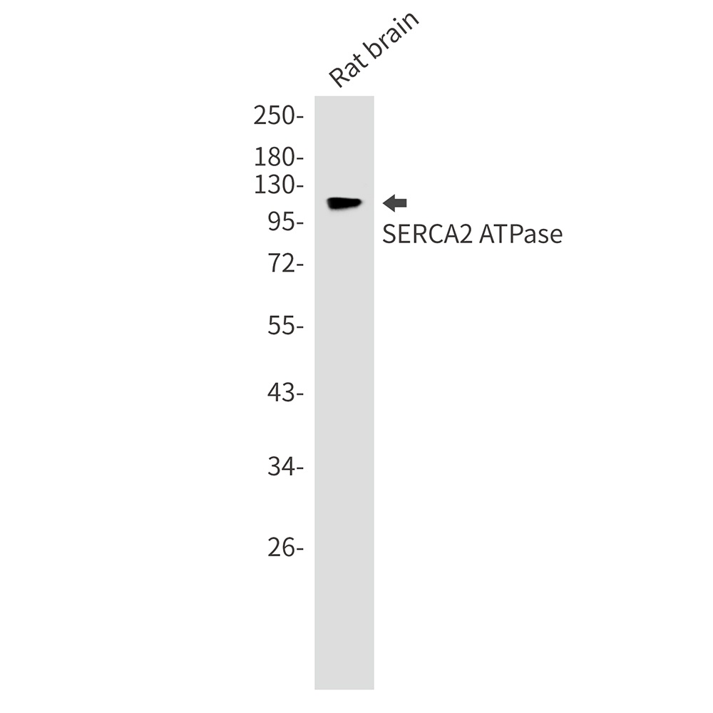 SERCA2 ATPase Rabbit mAb抗体,orb
