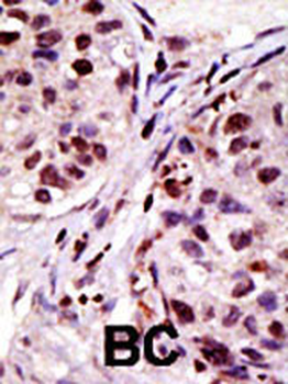 HGS Antibody (N-term)抗体，orb337