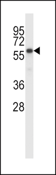 BIRC2 Antibody (Center)抗体,orb3