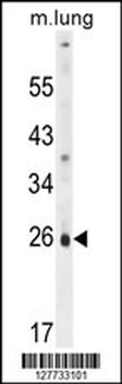 PQLC1 Antibody (Center)抗体，orb2