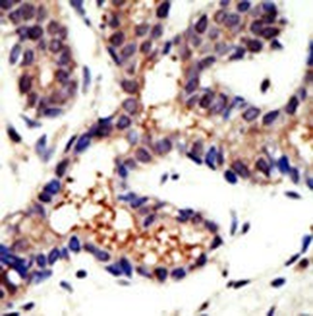 Ubiquilin3 Antibody (N-term)抗体