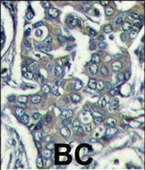 EIF4E2 Antibody (N-term)抗体，orb