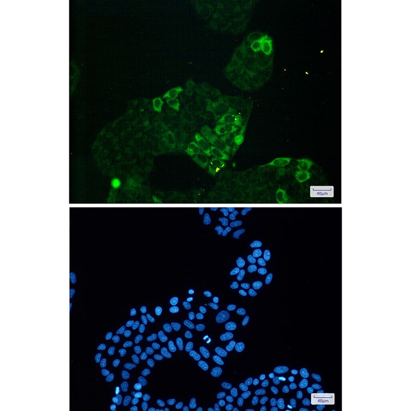 [KD] Cyclin B1 Rabbit mAb抗体，or