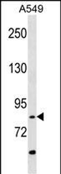 RIPK4 (ANKRD3) Antibody (C-ter
