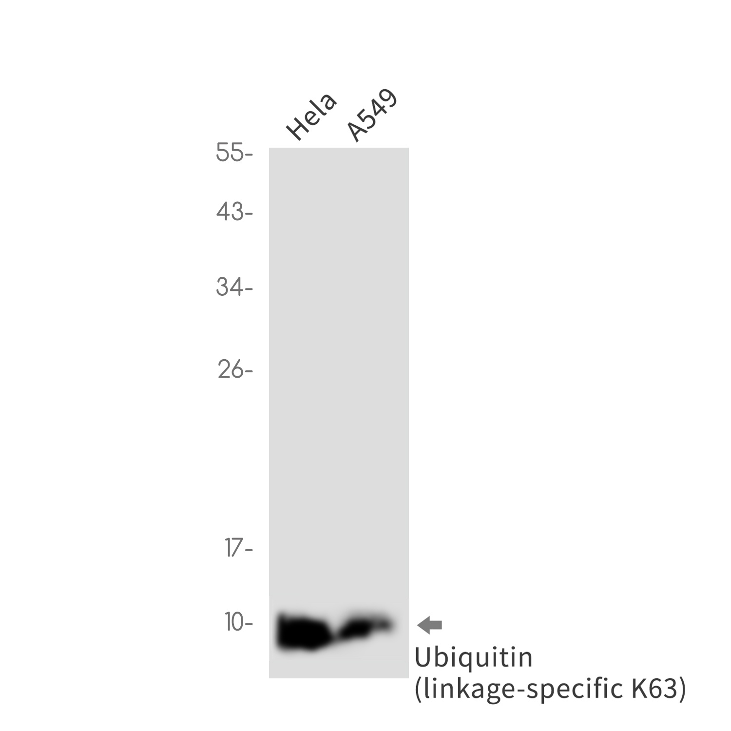 Ubiquitin K63 Rabbit mAb抗体，orb