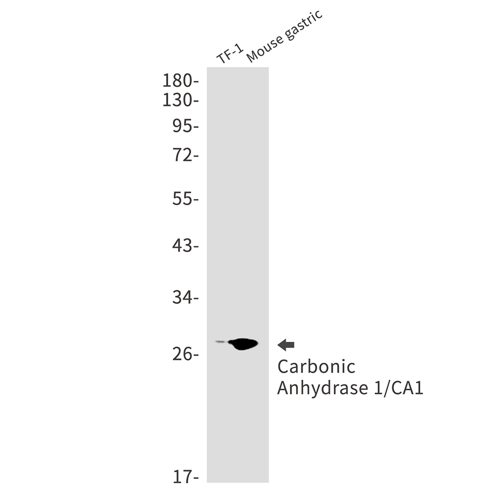 Carbonic Anhydrase 1 Rabbit mA