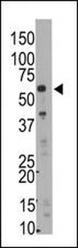 SMYD5 (RAI15) Antibody (C-term