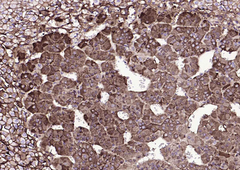 Tyrosine Hydroxylase Recombina