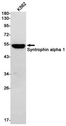 Syntrophin alpha 1 Rabbit mAb抗