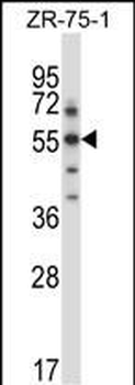 Mouse Sgk3 Antibody (C-term)抗体