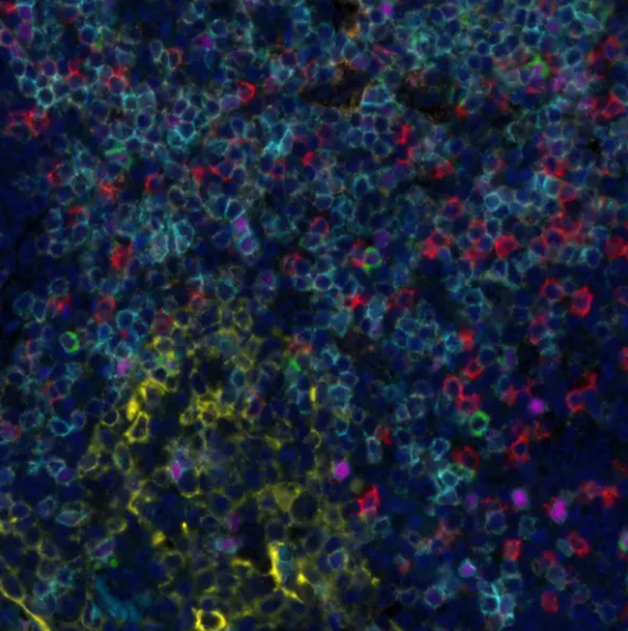 Rabbit anti-LAG3 Recombinant M