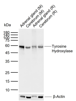 Tyrosine Hydroxylase Recombina