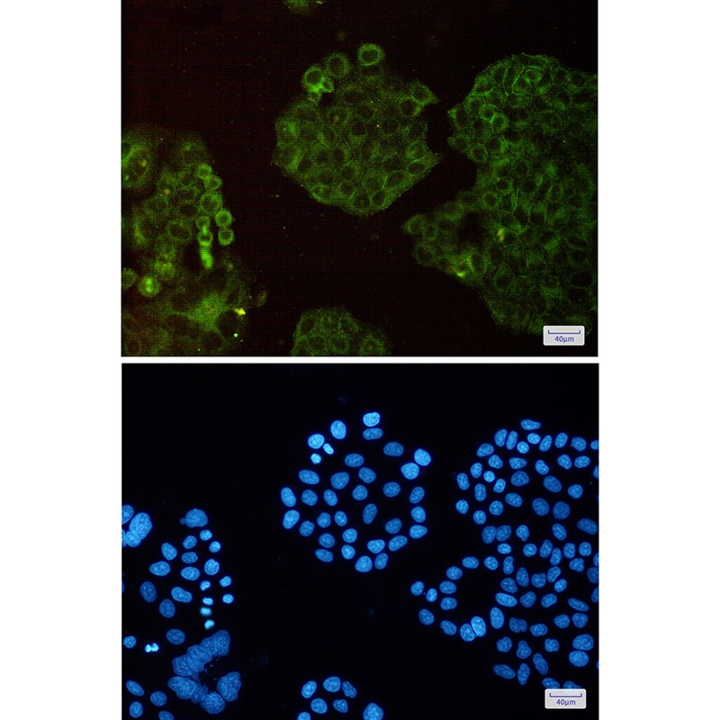 Actin Related Protein 3 Rabbit