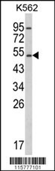 CYP2E1 Antibody (C-term)抗体，orb