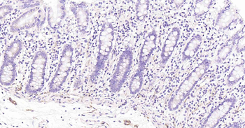 Podoplanin Recombinant Rabbit 