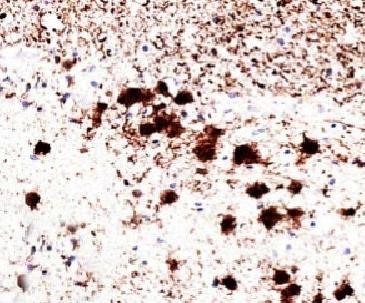 PGP9.5 / UchL1 (pan-Neuronal M