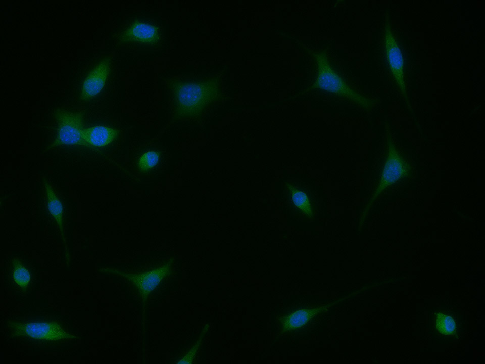 SerpinB2（PAI-2）功能解码的关键工具