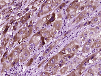 PSMB8 Rabbit Polyclonal Antibo