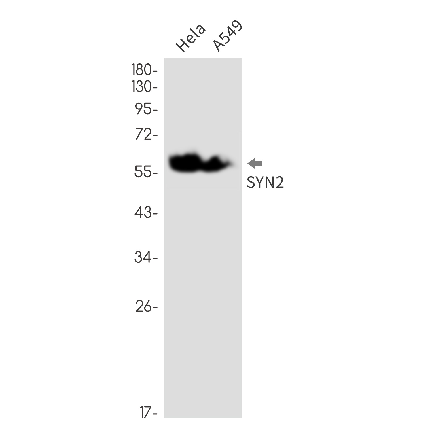 Synapsin 2 Rabbit mAb抗体，orb156