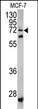 SCFD1 Antibody (C-term)抗体，orb3