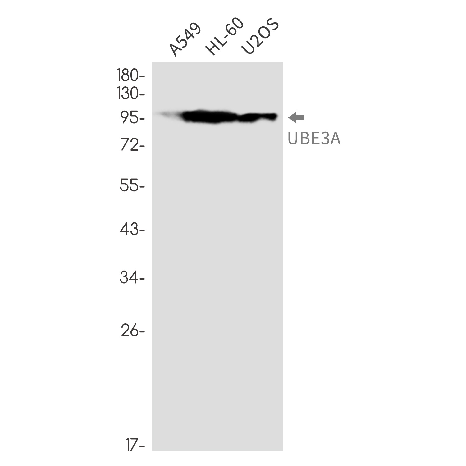 Ubiquitin Protein Ligase E3A R