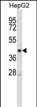 Mouse Stk25 Antibody (C-term)抗