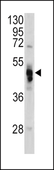 GLA Antibody (N-term)抗体，orb142
