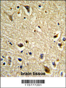 CYP2E1 Antibody (C-term)抗体，orb