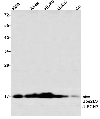 Ubiquitin Conjugating Enzyme E