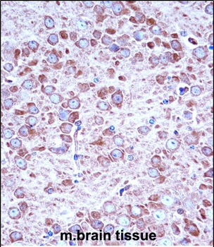 Mouse Aak1 Antibody (Center)抗体