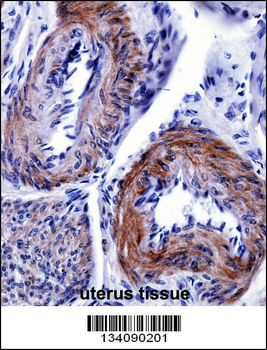 TRIP6 Antibody (N-term)抗体,orb1
