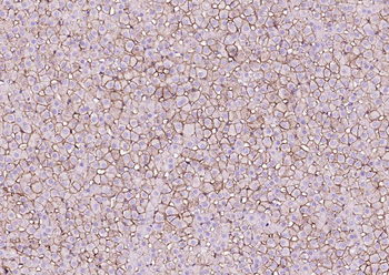 SCARB1/Scavenger Receptor BI R