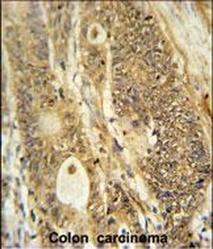 AVIL Antibody (N-term)抗体，orb35