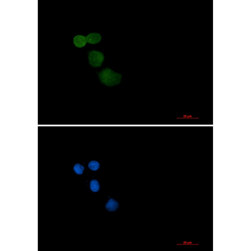Ubiquitin Protein Ligase E3A R