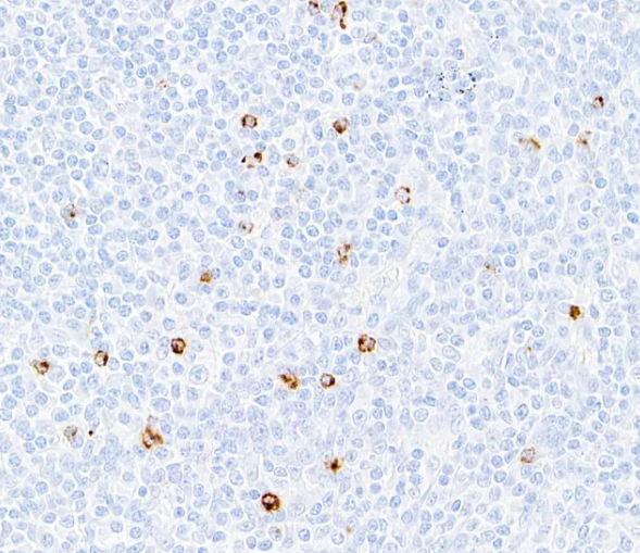 Rabbit anti-LAG3 Recombinant M