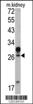 HOXA5 Antibody (C-term E211)抗体