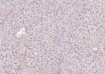 SCARB1/Scavenger Receptor BI R