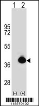 POLDIP2 Antibody (C-term)抗体,or