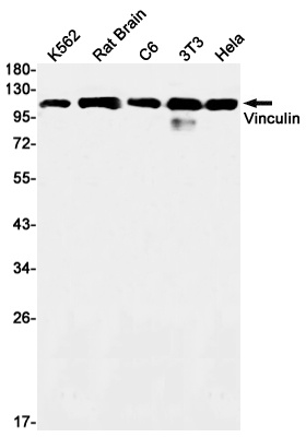 Vinculin Rabbit mAb抗体,orb15640