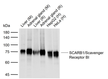 SCARB1/Scavenger Receptor BI R