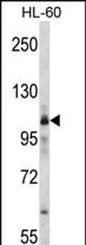 MARS Antibody (C-term)抗体，orb38