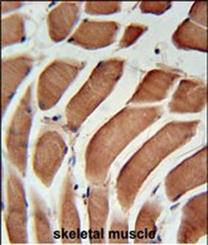 SIKE Antibody (C-term)抗体,orb35