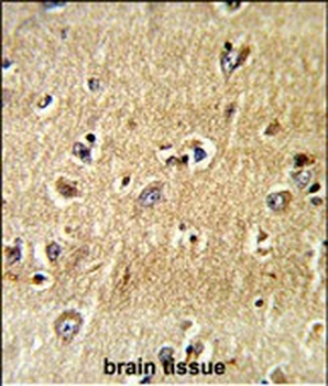 SCFD1 Antibody (C-term)抗体，orb3