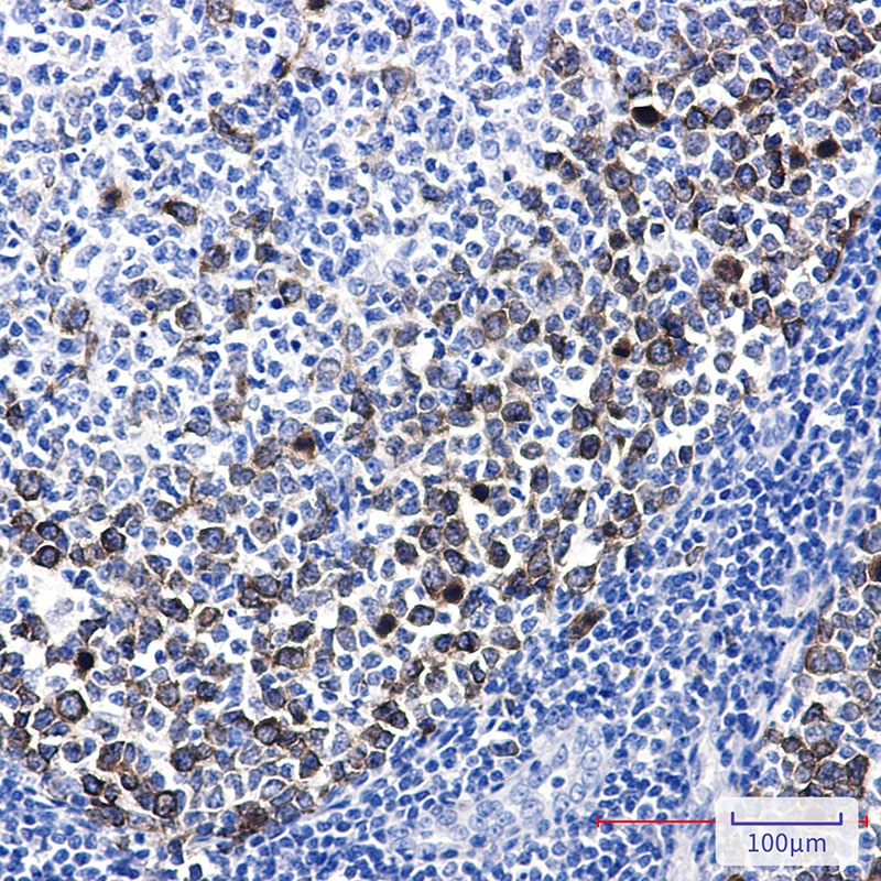 TACC3 Rabbit mAb抗体，orb1563615，