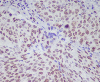 STAT1 (Phospho-Ser727) Rabbit 