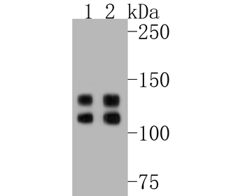 Integrin beta 1 Recombinant Ra