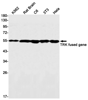TFG Rabbit mAb抗体，orb1564138，bi