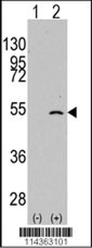 ELP3 Antibody (C-term)抗体，orb29