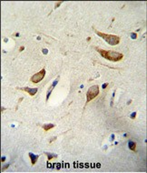 WBP2 Antibody (N-term)抗体，orb38