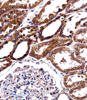 BIRC2 Antibody (Center)抗体,orb3